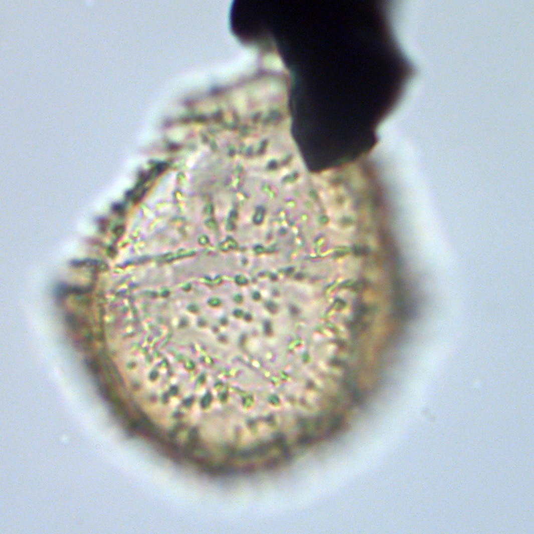 Leptodinium pustulatum, U1581-18R-1W, 10-14, sl. 1, L34-1, foto-b.jpg